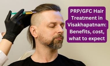 PRP & GFC Hair Treatment in Visakhapatnam for Hair Regrowth