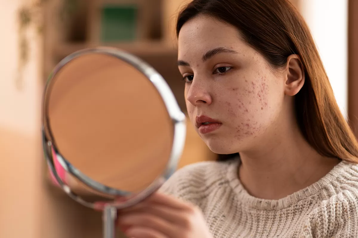 Psoriasis illustration