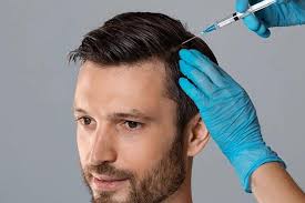 HairPRP Removal