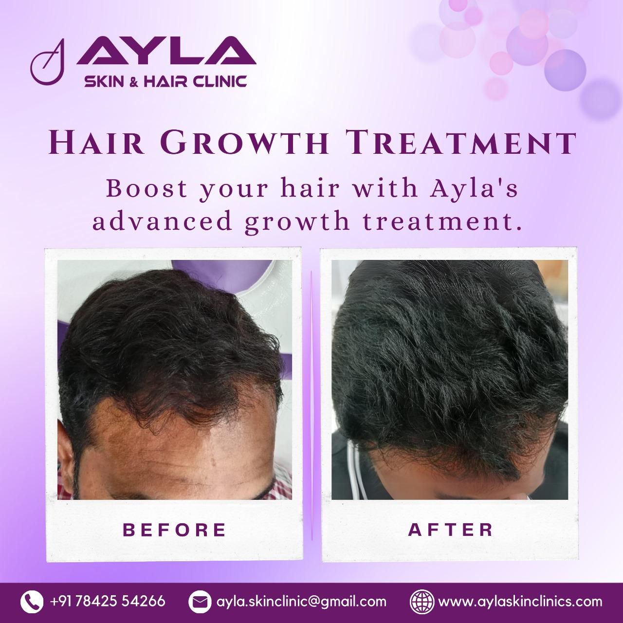 Before After 1