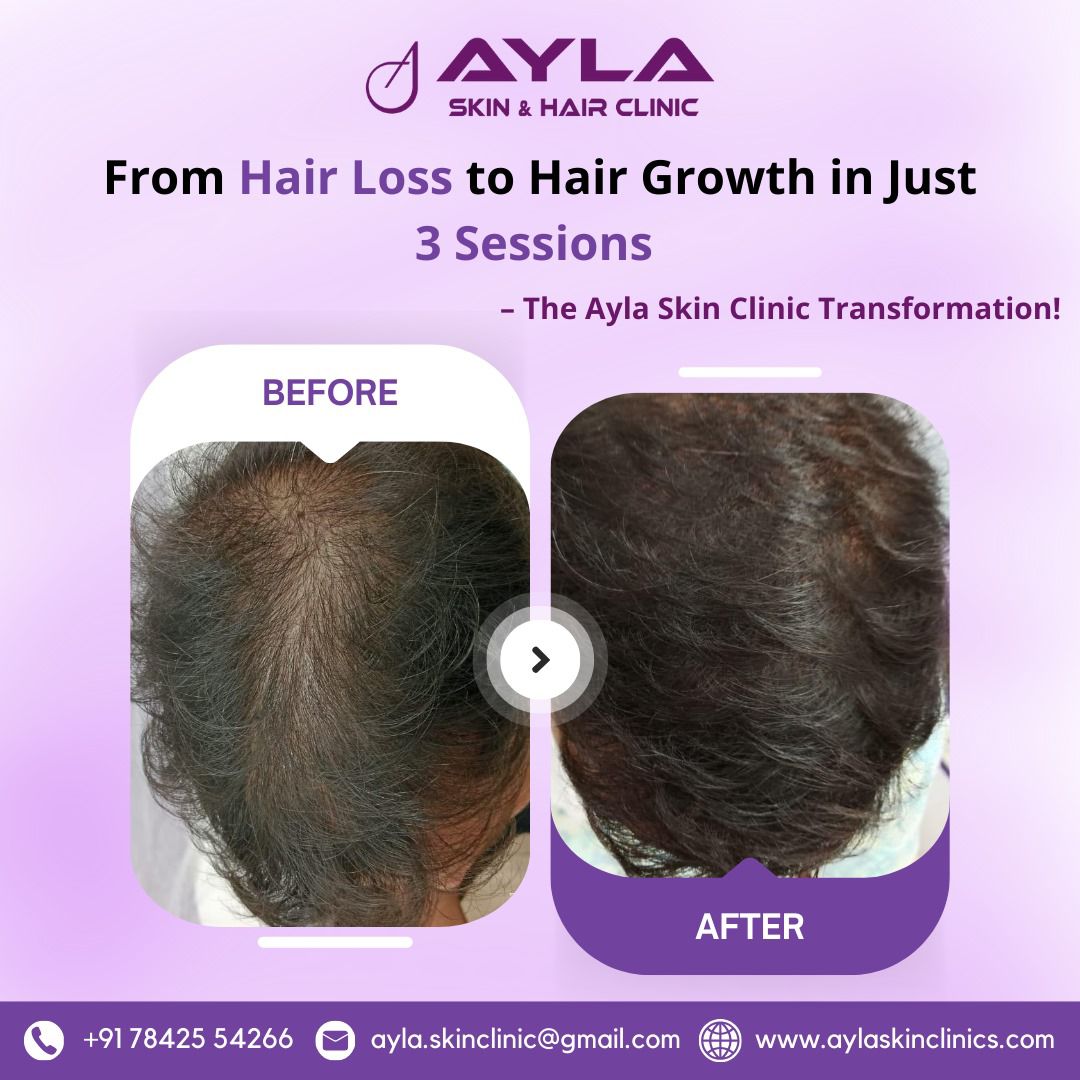 Before After 3