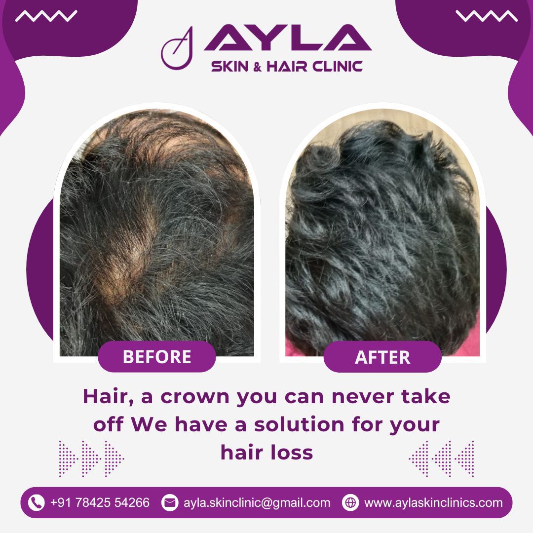 Before After 5